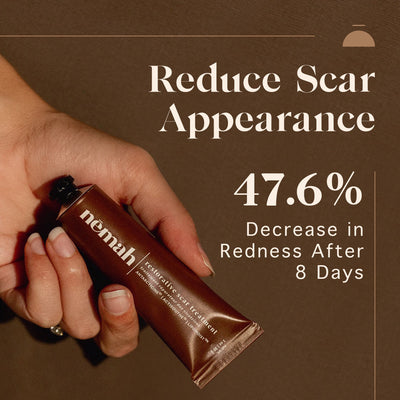 Nēmah Renewing Scar Cream